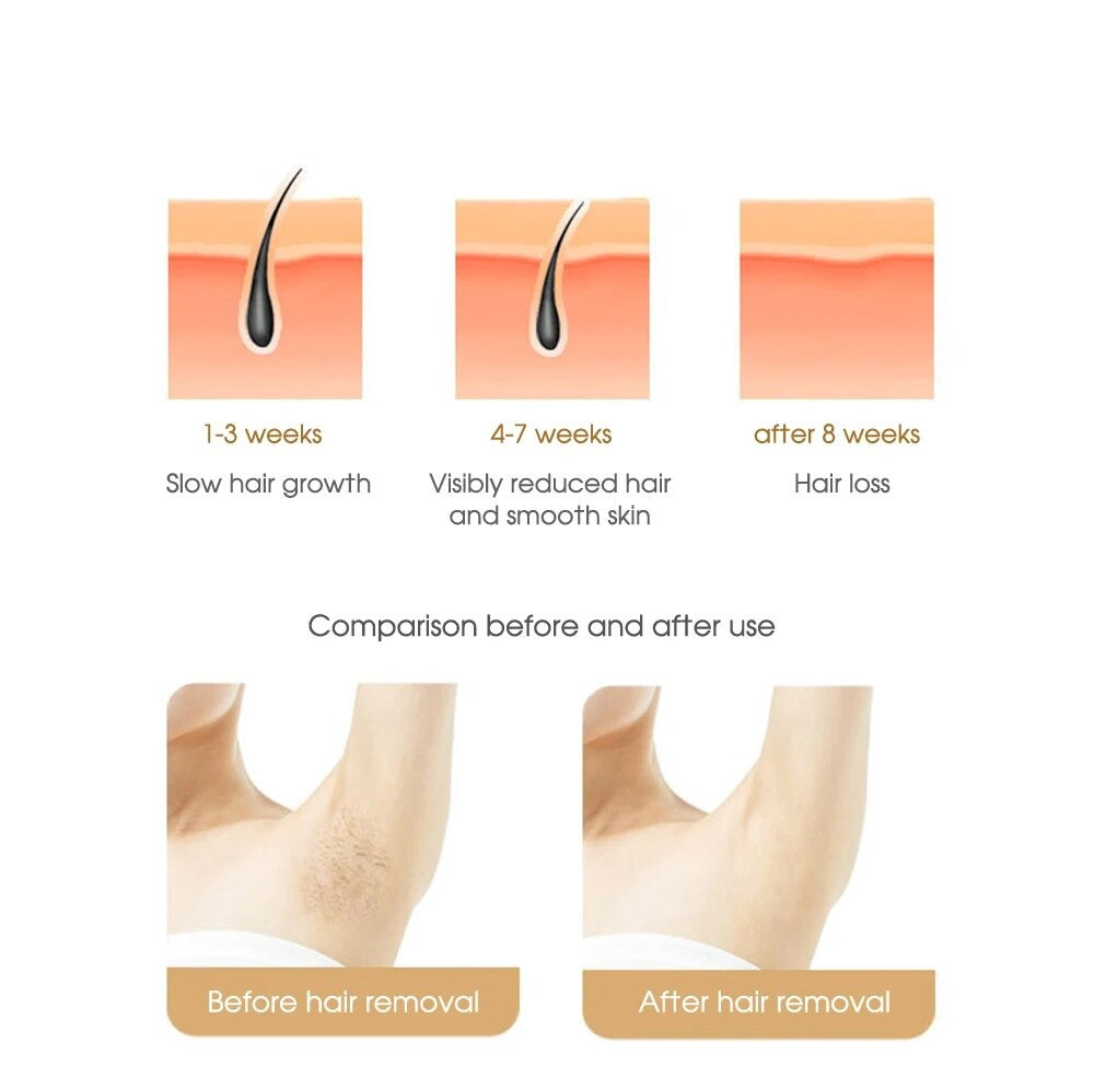 EverSilk™ - IPL Permanent Hair Removal | Painless